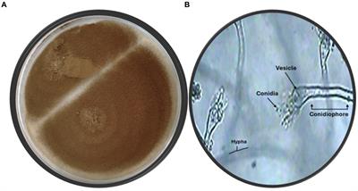 Bio-fabricated zinc oxide nanoparticles mediated by endophytic fungus Aspergillus sp. SA17 with antimicrobial and anticancer activities: in vitro supported by in silico studies